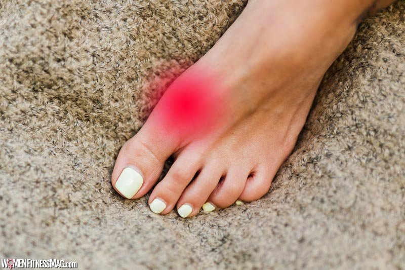 Gout Pain Relief: Natural Remedies and Treatment Options