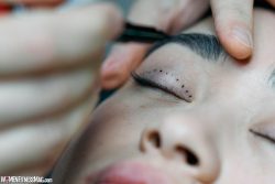 Your Comprehensive Guide to Eyelid Surgery
