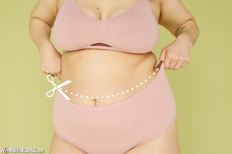 4 Considerations Before Undergoing a Tummy Tuck