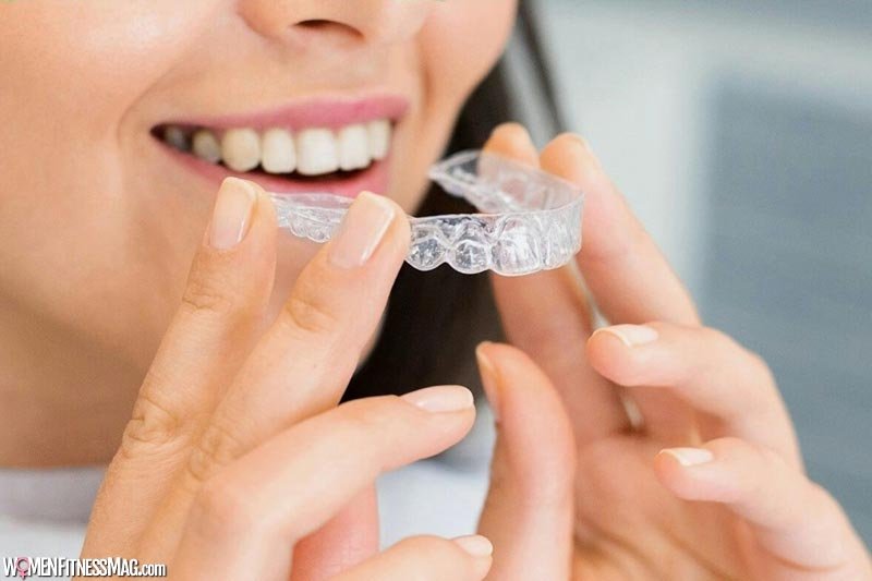 Unraveling the Expense of Invisible Braces for Orthodontic Patients