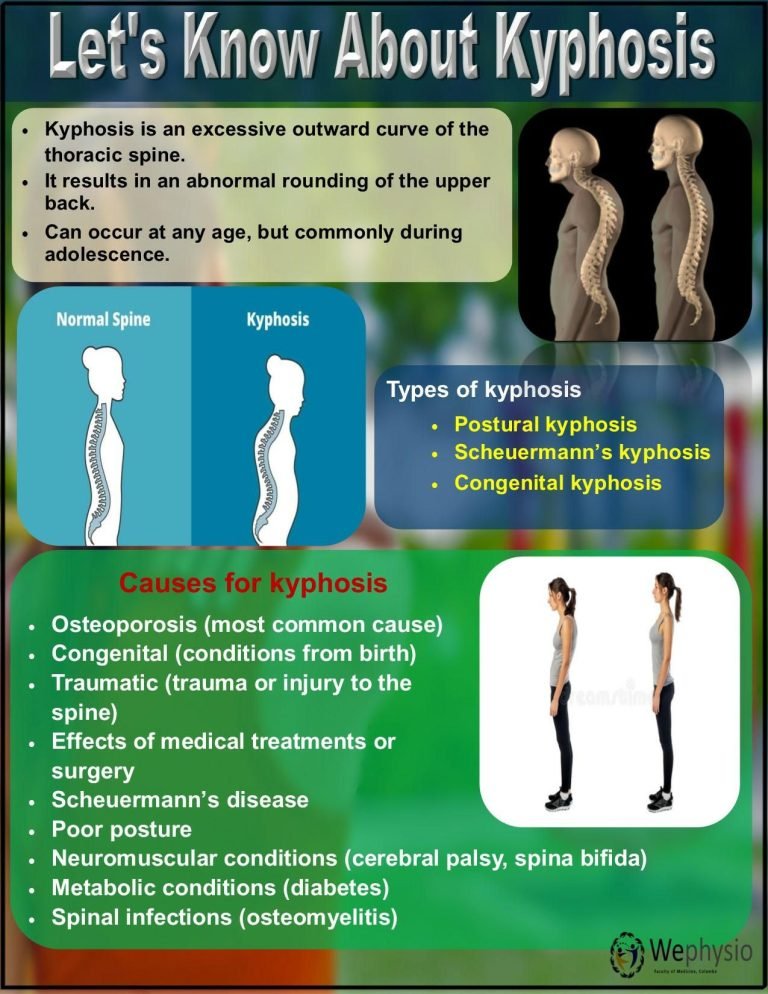 Kyphosis Treatment Options What You Need To Know