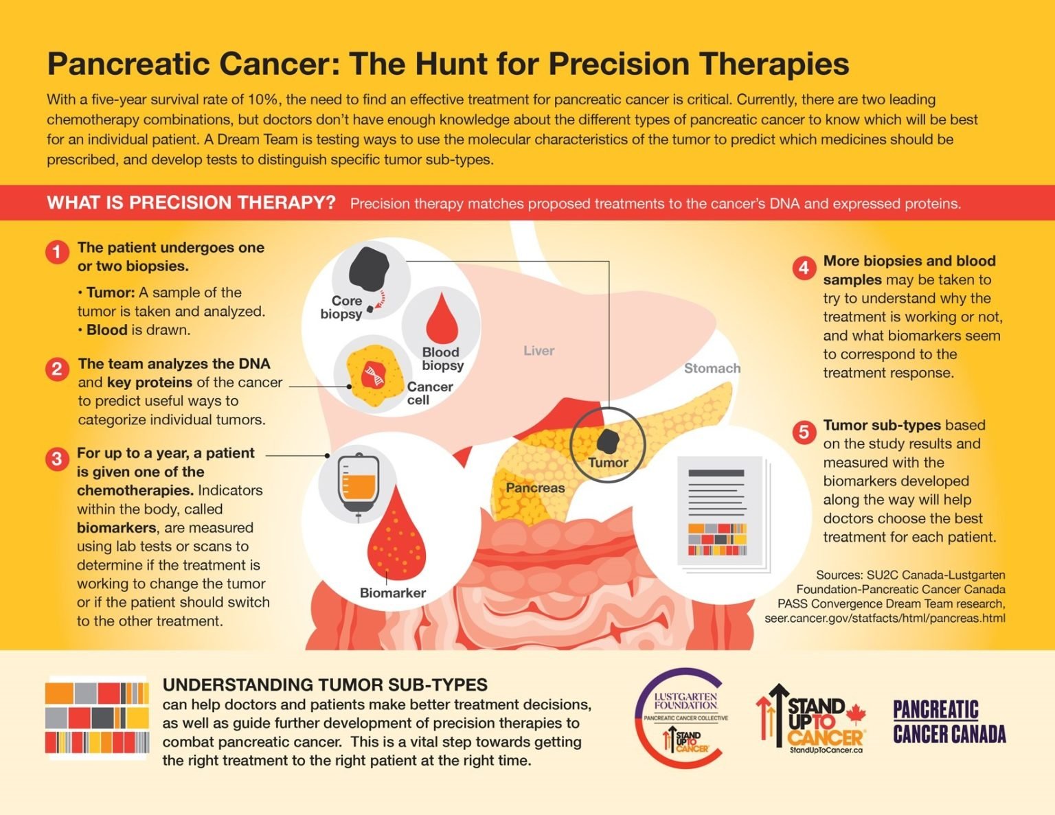 Nanomedicine: A New Hope in the Fight Against Pancreatic Cancer