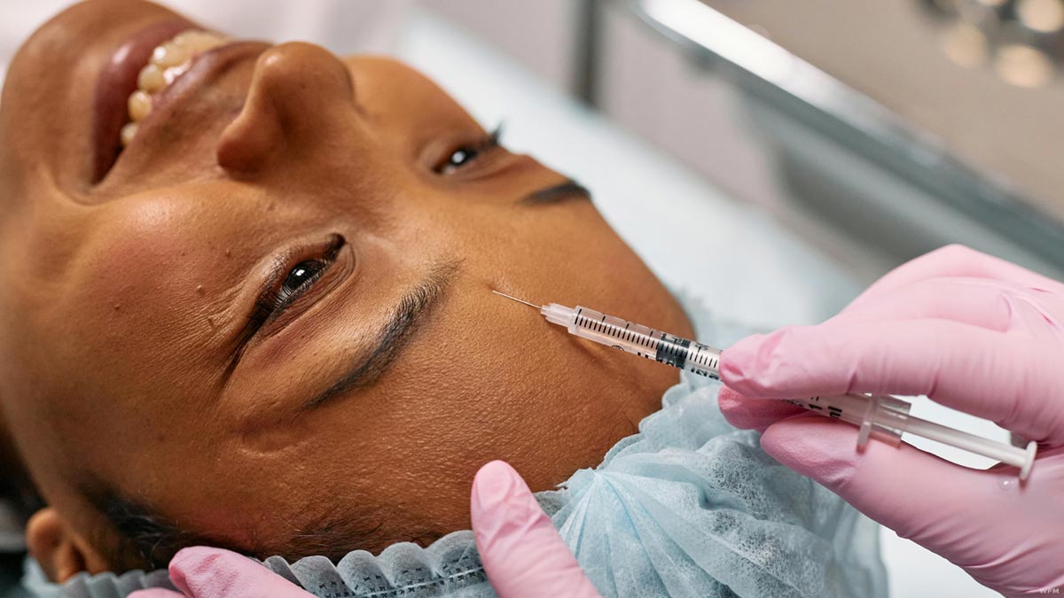 Dermal Fillers